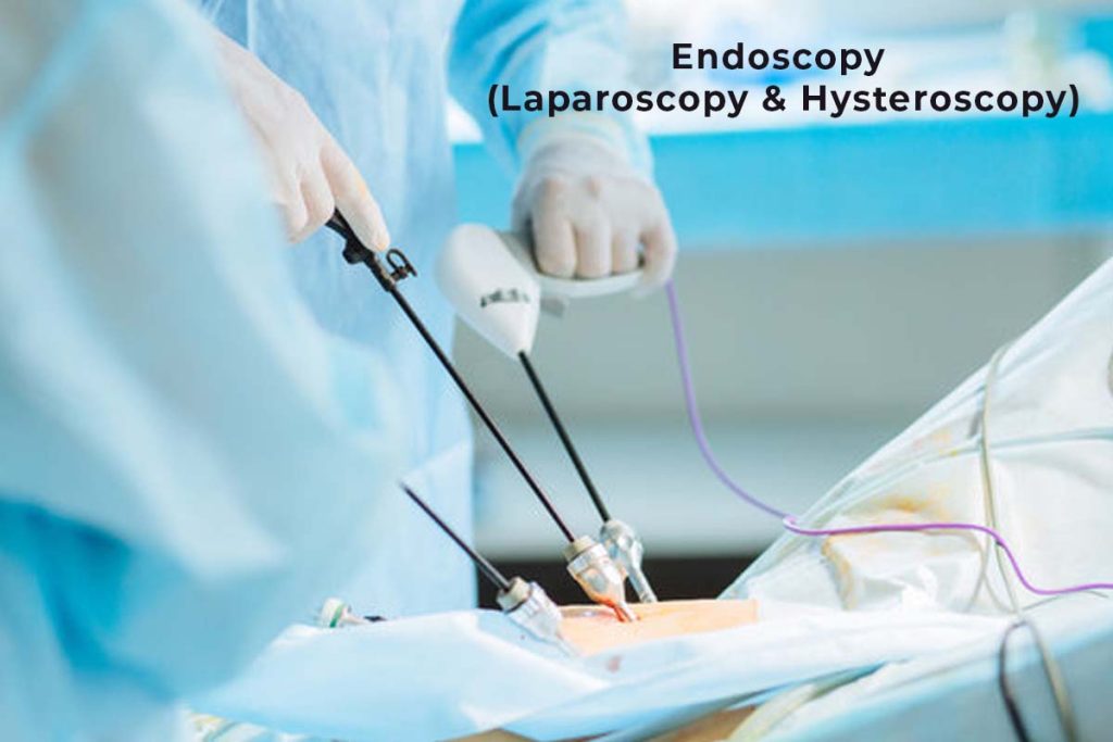 Endoscopy (Laparoscopy & Hysteroscopy) - Birth Help Guntur