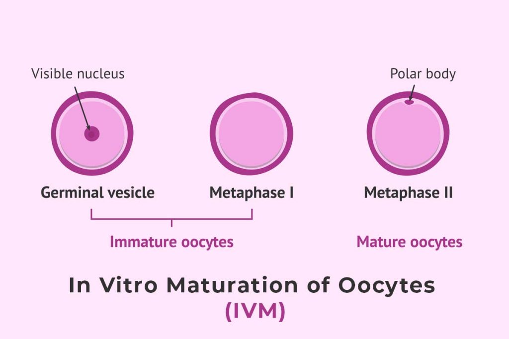 In Vitro Maturation of Oocytes - Birth Help Guntur