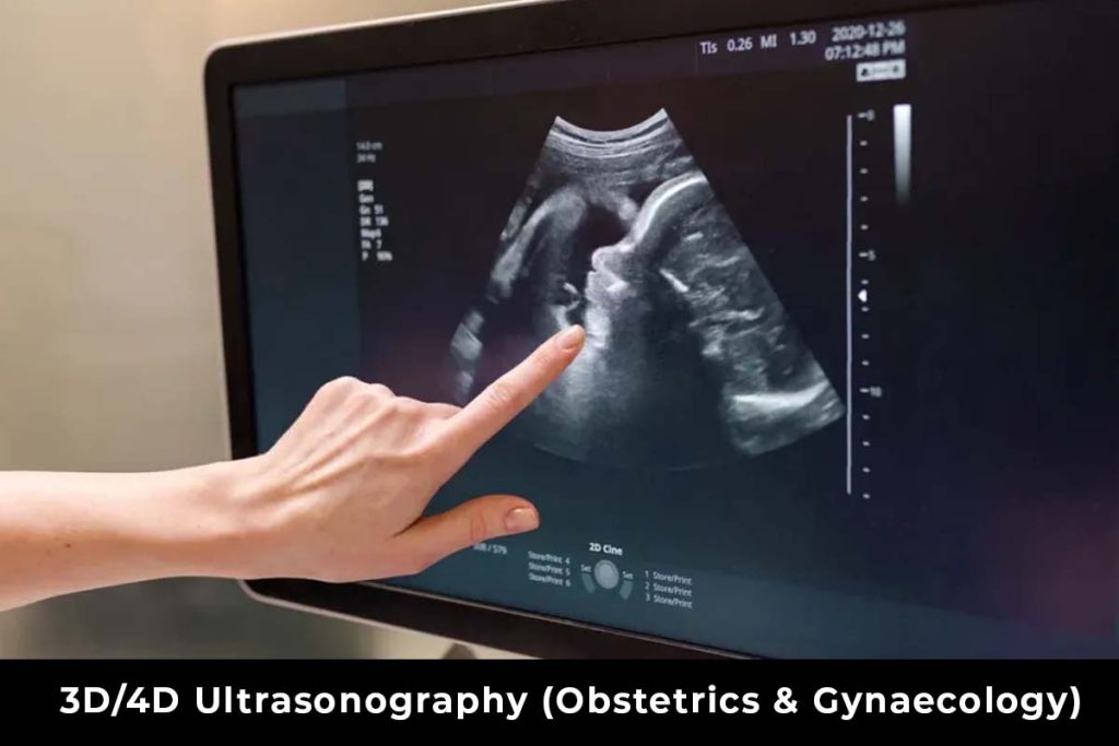 3D/4D Ultrasonography - Fertility Price in Guntur