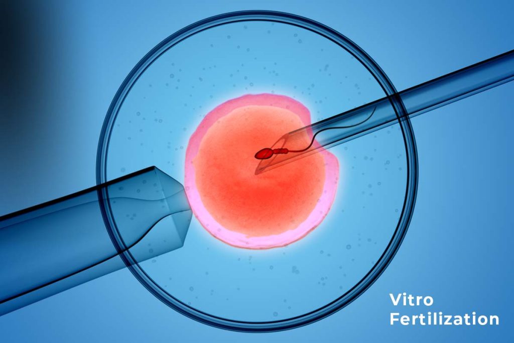 In Vitro Fertilization - Birth Help Hospital Guntur